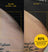 Before and after close-up images of bikini line skin showing reduced razor burn and bumps after using grooming pads.