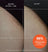 Before and after close-up images showing reduced skin irritation and smoother bikini line area after using a skincare scrub for 4 weeks.