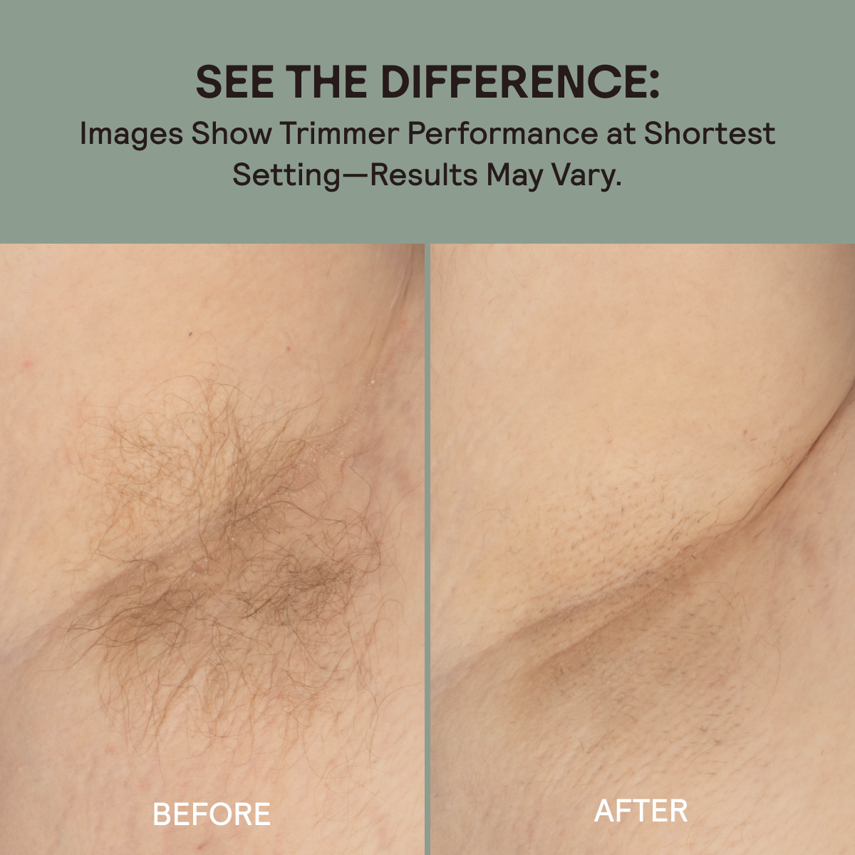 Before and after using the slimmer trimmer on the armpit